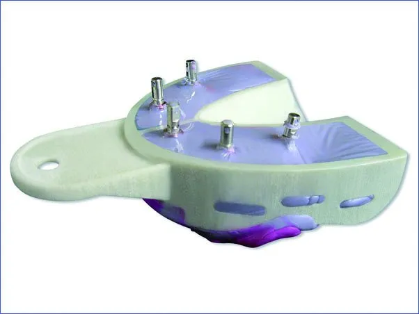 Miratray Implant Large Upper S3 6pcs