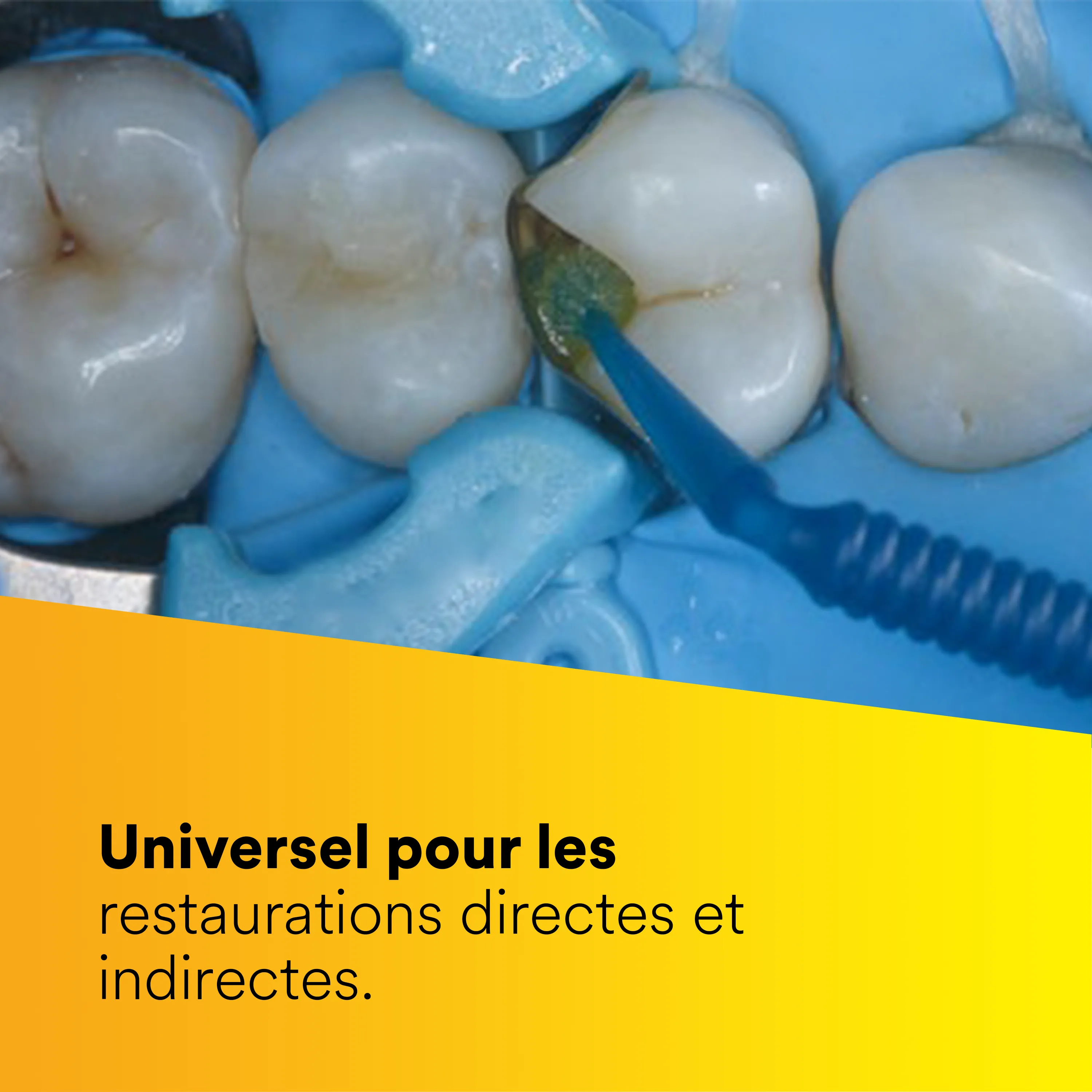 3M™ Scotchbond™ Universal Plus Adhésif, 1 flacon de 5 ml