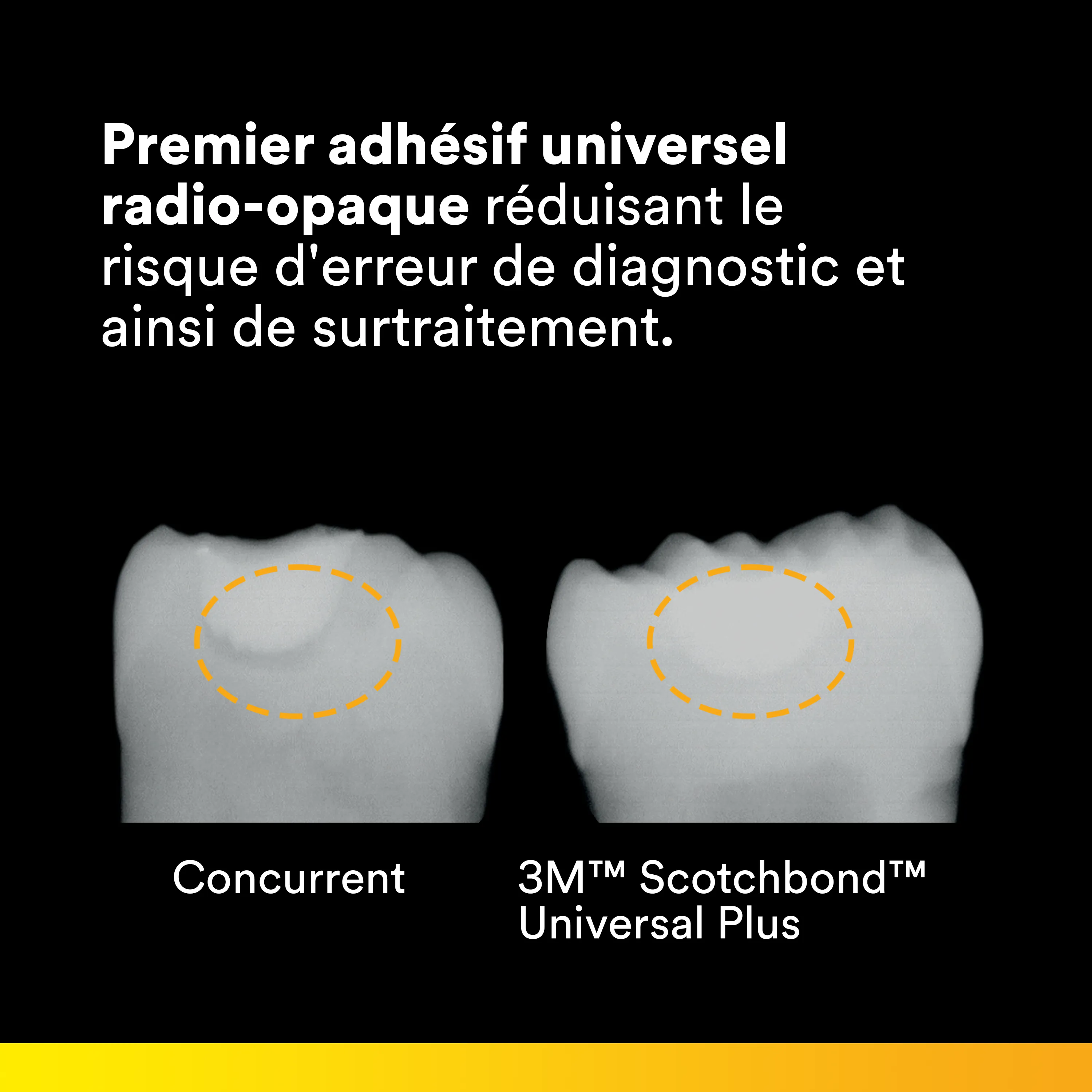 3M™ Scotchbond™ Universal Plus Adhésif, 3 flacons de 5 ml