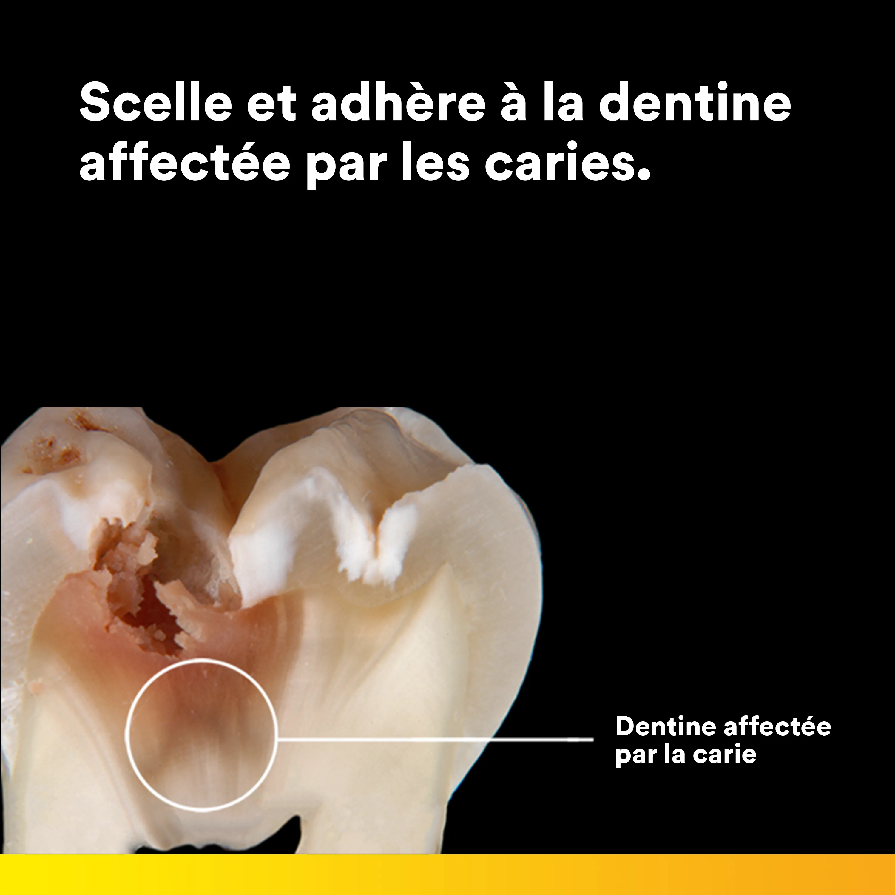 3M™ Scotchbond™ Universal Plus Adhésif, boîte d'introduction avec 50 L-Pop