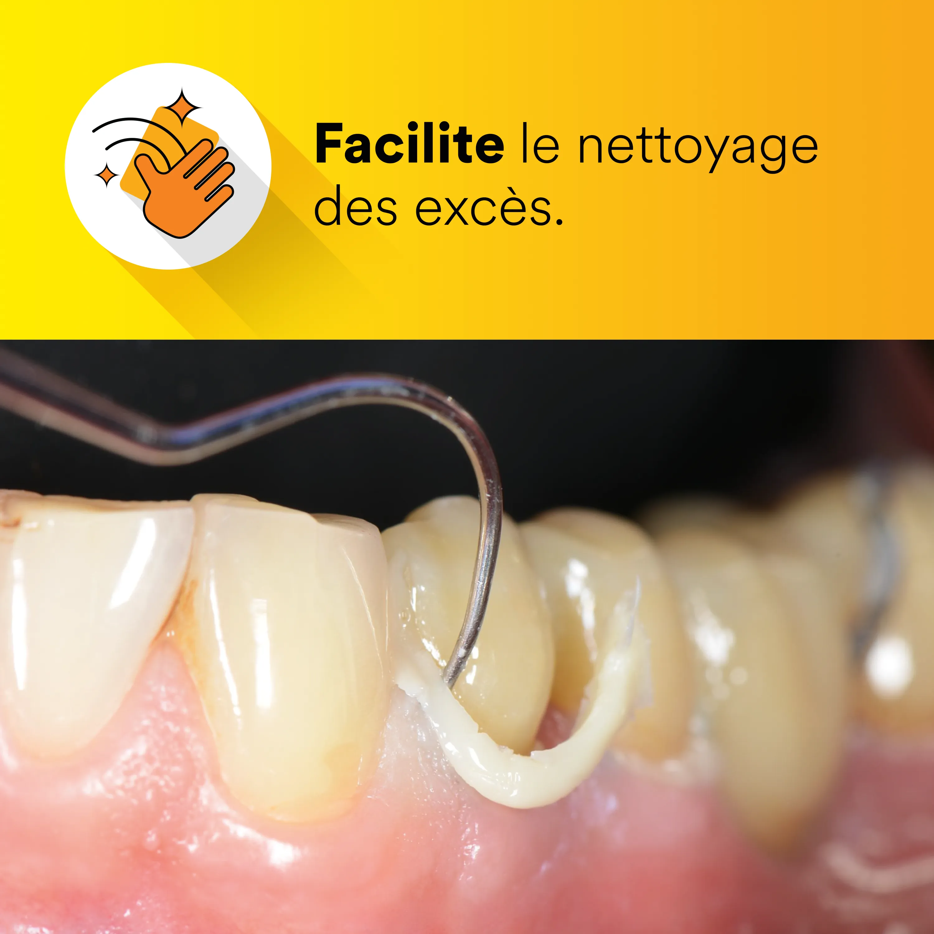 3M™ RelyX™ Universal Ciment-composite de collage, pack économique, teinte Translucide
