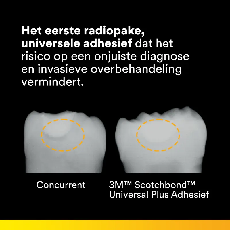 3M™ Scotchbond™ Universal Plus Adhesief Single-Unit Dose 200
